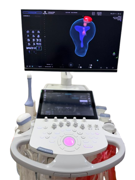 Kutch first AI integrated sonography center